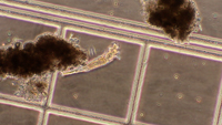 rotifer size